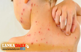 මෙරටින් තුරන්කල සරම්ප යළි හිස ඔසවයි ? කොළඹින් රෝගීන් දෙදෙනෙක් !